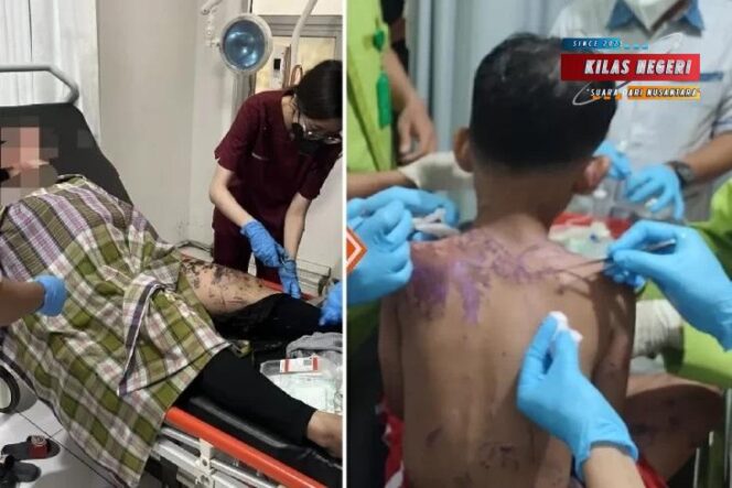 
Law Office DRH & Partner Berkordinasi Dengan Pihak KPAI Tentang Kasus Penyiraman Air Keras Ibu dan Anak Di Sukabumi