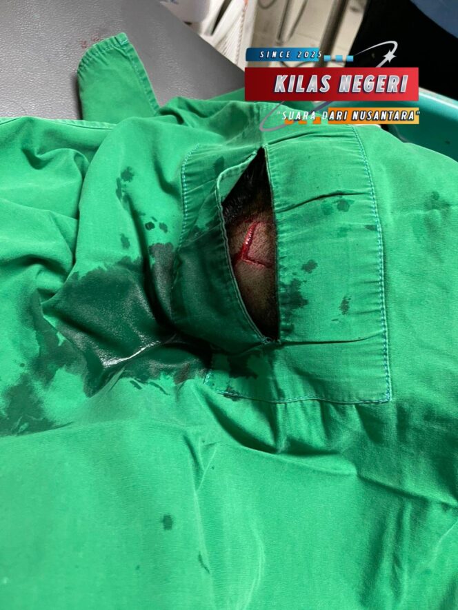 
Polsek Matraman Tangani Kasus Penganiayaan di Pisangan Baru, Pelaku Diamankan